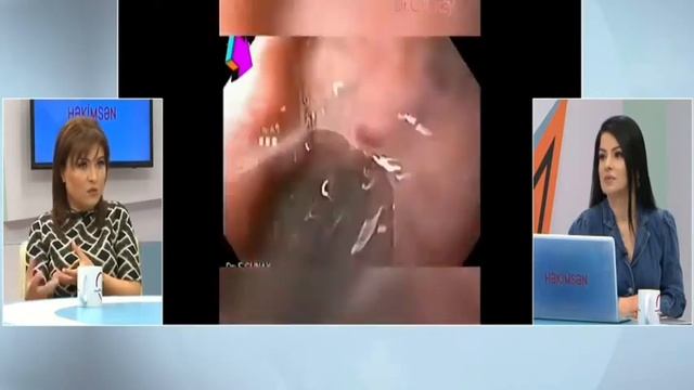 Qaraciyər Xəstələrinə nə üçün endoskopiya lazımdır? смотреть онлайн