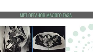 МРТ органов малого таза