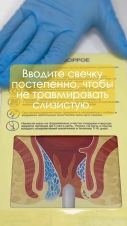 КАК ПРАВИЛЬНО ВВОДИТЬ СВЕЧКУ? СПРОСИ ПРОКТОЛОГА! #shorts #доктор #онлайн #консультация