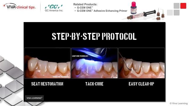 Dr. Cone on G-CEM ONE and G-CEM ONE Adhesive Enhancing Primer смотреть онлайн