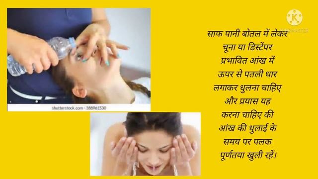 आंख में चूना चला जाए तो क्या करें/आंख में डिस्टेंपर या चुना चला जाए तो क्या उपाय करे / Eye Injury смотреть онлайн