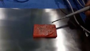 Electrosurgical Unit  & Vessel Sealer Demonstration