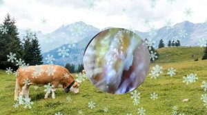 Ear Wax Removal Eps# 142|| чистка ушной серы #142