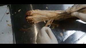 9  Dorsum of foot   II