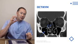 Модуль 1 Урок 1 Анатомия верхней и нижней челюстей
