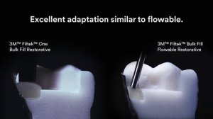 3M Filtek One Bulk Fill Adaptation Comparison Video