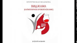 Хиджама - капиллярное кровопускание
