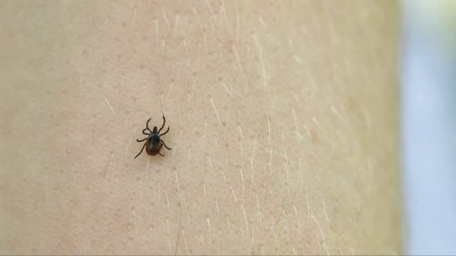 Find a tick? Send it to this Colorado vet смотреть онлайн