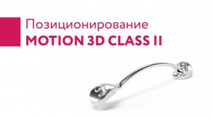 Установка аппарата Motion Class II