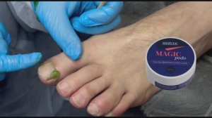 4 способа обработки кутикулы в педикюре. Подология и педикюр