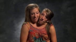 Двухголовая девушка   Моя Ужасная История