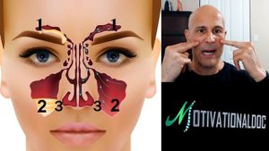 Dr. Mandell's Sinus Tapping (60 Seconds) for Instant Drainage, Headaches, and Tinnitus