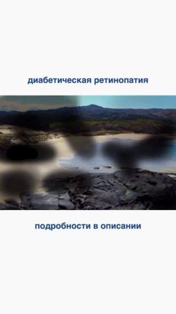 подробности в описании