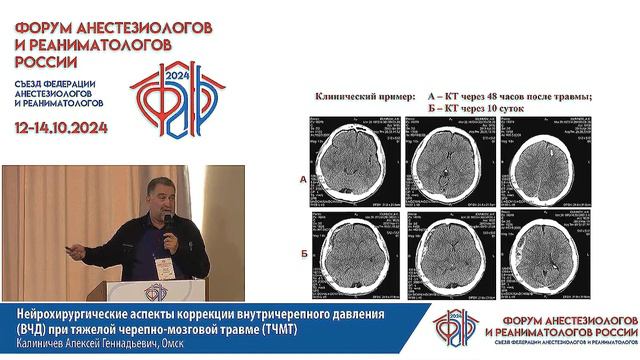 Коррекция ВЧГ нейрохирургия Калиничев А.Г.   ФАРР 2024