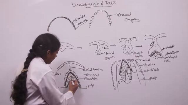 Development of teeth | General Anatomy | Indian Dental Academy смотреть онлайн