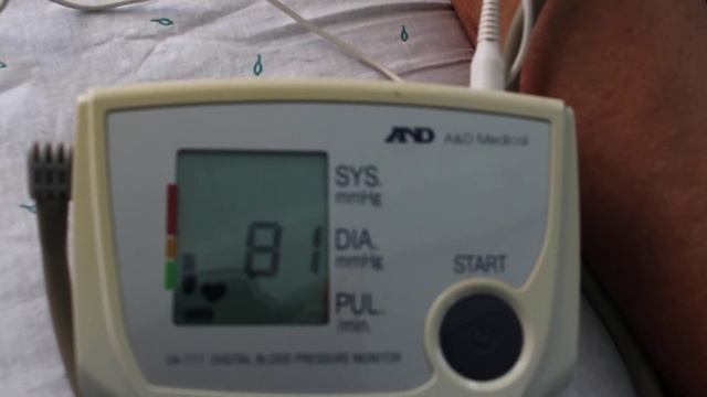 По состоянию на 1 сентября 2020 года, моё артериальное давление 108/73-60!!! смотреть онлайн