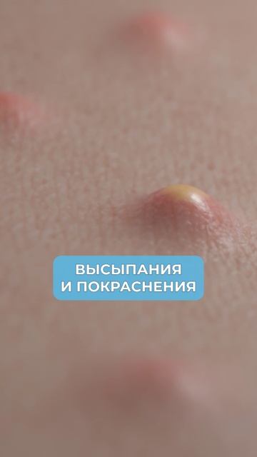 ЭТА процедура ВЕРНЕТ коже молодость и ровный тон! #косметология #молодость #красота