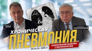 Клинические разборы с рентгенологом. Профессор Тюрин. 06.02.25, кейс 4