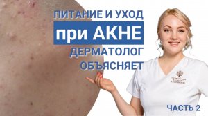 Питание и уход при акне: мнение врача-косметолога профессорской клиники Юцковских.