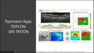 Цикл лекций по ОКТ Особенности протоколов ОКТ TOPCON DRI TRITON