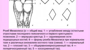 Ромб Михаэлиса