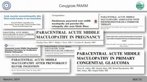 Ангио-ОКТ в офтальмологической практике