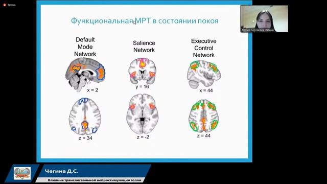 Транслингвальная нейростимуляция. Доказательная База. Чегина Дарья Сергеевна