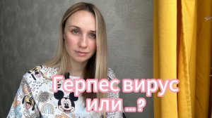Герпес вирус или … ?