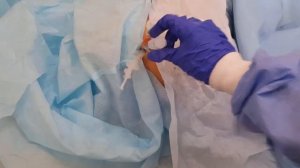 Делаю своего  любимого ежика. Сделал всего 5 штук.Доктор Уткин в ударе