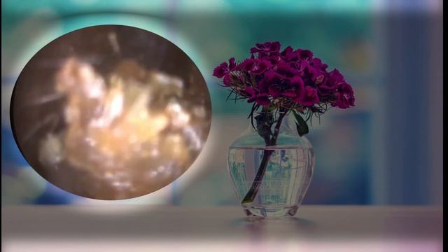 EarWax Blockage Removal 2021 смотреть онлайн