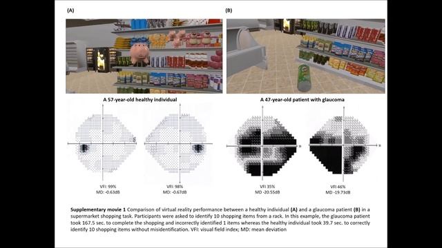 Glaucoma Disability During Virtual Reality (VR) Supermarket Shopping смотреть онлайн