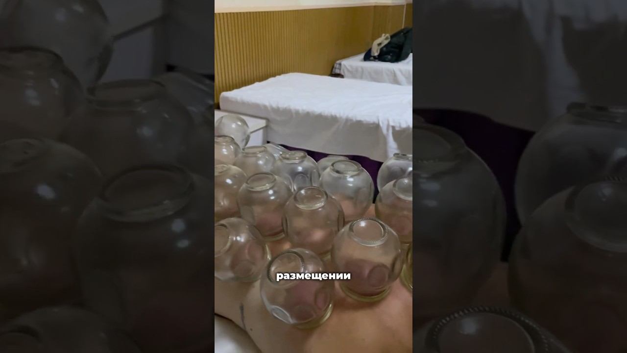 Банки на спине #китай #культура #китайроссия #путешествия #банки