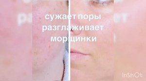 Биоревитализация без уколов с эффектом ВВ крема