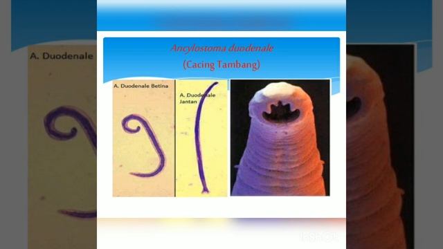 Tahu Cacing Tambang? Bahaya ngak sih? #Cacing #Necator #Ancylostoma #Parasit смотреть онлайн
