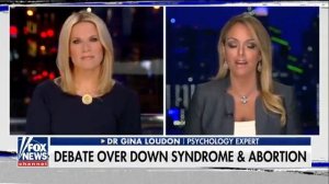 Down syndrome in all its aspects - Only in English