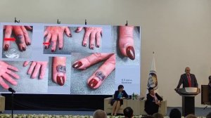 Сибирская язва . История сибирской язвы и течение болезни