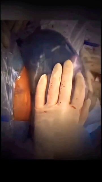 Newborn baby with amniotic sac# incredible birth# unboxing new life# womb bag# how babies are born