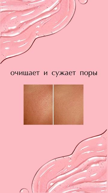 Беспокоят высыпания на коже?