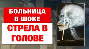 "Мне не больно" - Стрела застряла в голове. Реальная история.