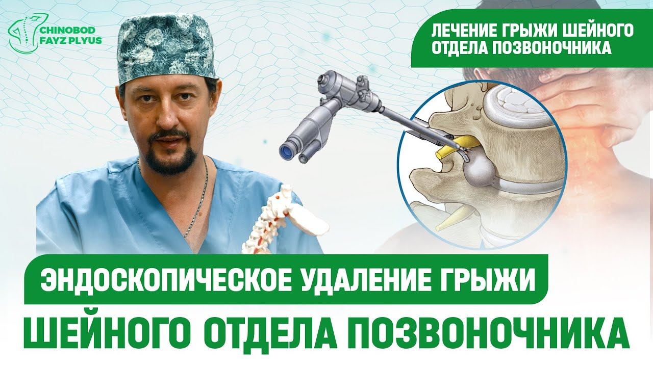 Эндоскопическое удаление грыжи шейного отдела позвоночника