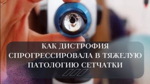Клинический случай из практики врача-офтальмохирурга, лазерного хирурга Кашевой Ирины Дмитриевны
