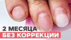 2 месяца с гель-лаком: чем это закончилось? Отслойки и трещины кутикулы