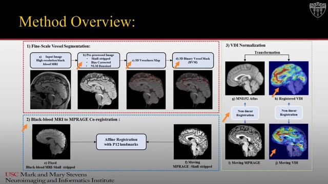 ISMRM 2022 - Brain small vessel density mapping смотреть онлайн