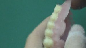 Съемные протезы из акрила