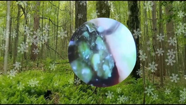 ear cleaning чистка ушной серы