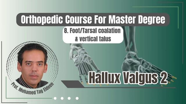 Hallux Valgus 2|| Foot Orthopedic course كورس عظام (ماجستير ودكتوراه) د. محمد تاج الدين