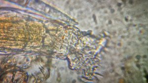 Коловратка