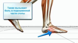 Не правильная ходьба Биомеханика распространённой ходьбы.