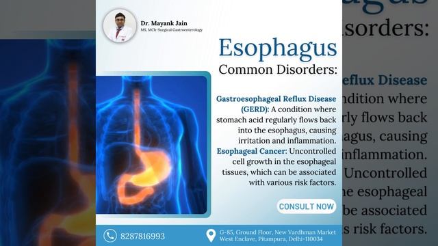Unlocking Esophageal Health: A Patient's Guide! #Gastroenterology