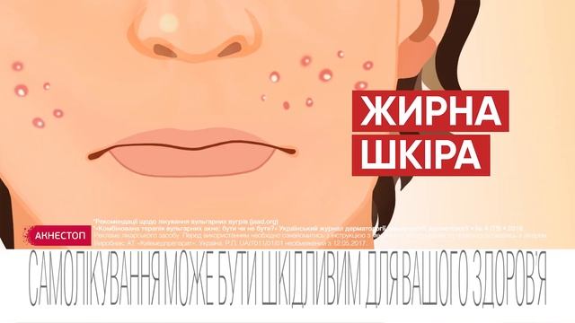 Акнестоп скажи акне "Стоп!" 20s смотреть онлайн